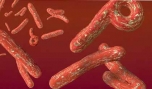 Bộ Y tế chỉ đạo khẩn việc phòng chống virus Ebola